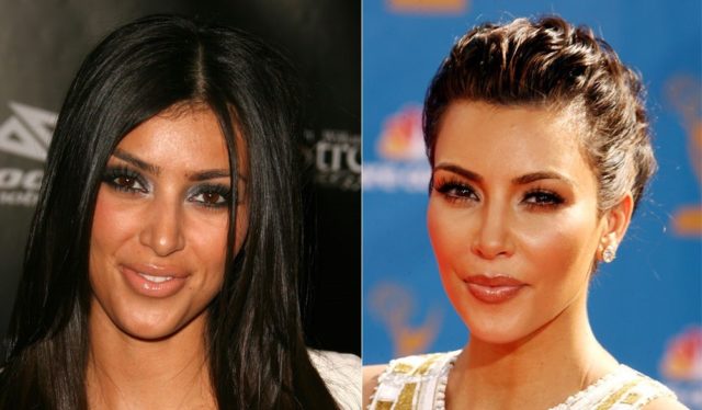 Kim Kardashian Antes y después de la cirugía plástica