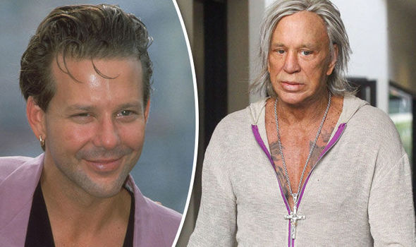 Mickey Rourke plastikkirurgi, Celebrity Plastic Surgery Disasters