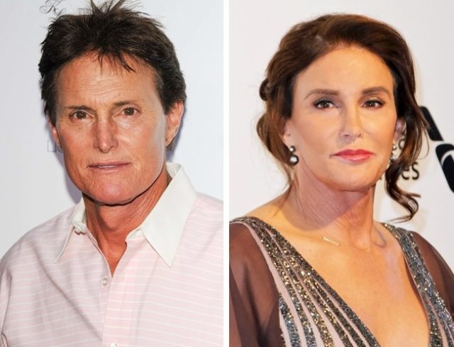 Caitlyn Jenner Brangiausios garsenybių plastinės chirurgijos