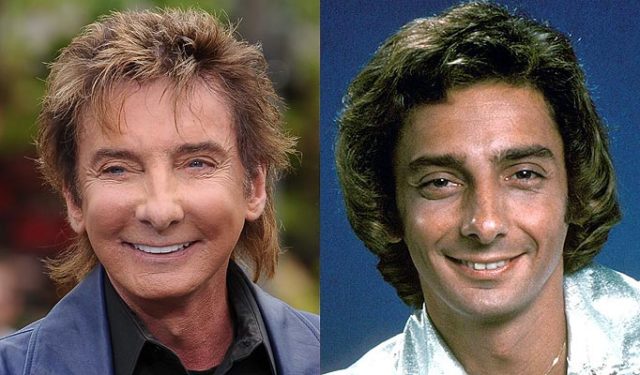 Barry Manilow, Cirugías plásticas de celebridades más caras